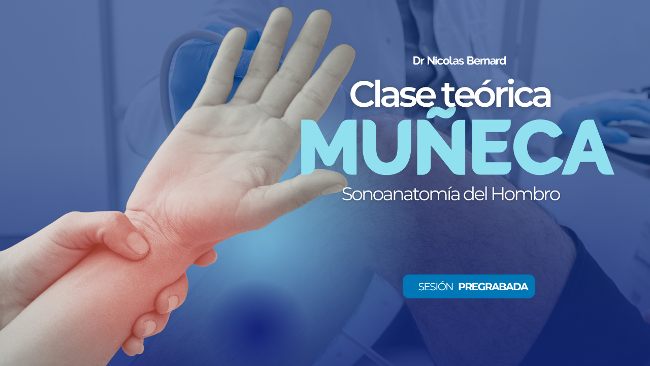 Cargar video: 