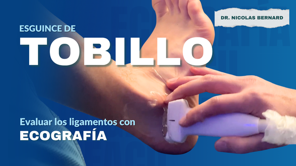 Esguince de Tobillo: Cómo Evaluar los Ligamentos con Ecografía (Paso a Paso)