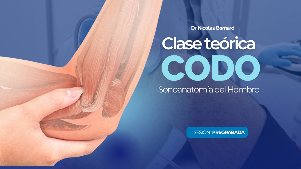 Cargar video: 